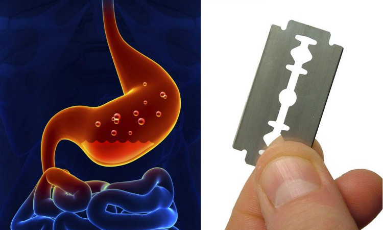 Human Stomach Can Dissolve Stainless steel.